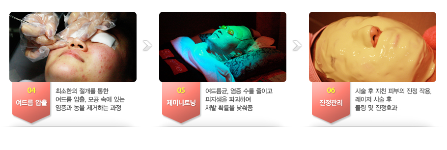 04.���帧 ����-�ּ����� ������ ���� ���帧 ����, ��� �ӿ� �ִ� ������ ���� �����ϴ� ����. 
05.���̴����-���帧��, ���� ���� ���̰� �������� �ı��Ͽ� ��� Ȯ���� ������. 
06.��������-�ü� �� ��ģ �Ǻ��� ���� �ۿ�, ������ �ü� �� �� �� ����ȿ��