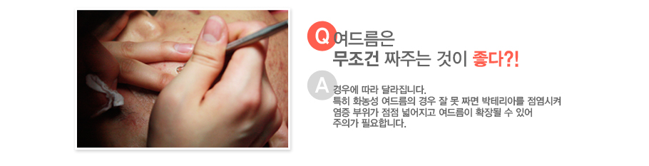 [����:���帧�� ������ ¥�ִ� ���� ����?!][�亯:��쿡 ���� �޶����ϴ�.Ư�� ȭ�� ���帧�� ��� �� �� ¥�� ���׸��Ƹ� �������� ���� ������ ���� �о����� ���帧�� Ȯ��� �� �־� ���ǰ� �ʿ��մϴ�.]