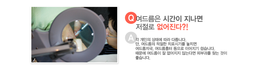 [����:���帧�� �ð��� ������ ������ ��������?!][�亯:�� ������ ���¿� ���� �ٸ��ϴ�. ��, ���帧�� ������ ġ��ñ⸦ ��ġ�� ���帧�ڱ�, ���帧���� ������ �̾����� �����ϴ�.������ ���帧�� �� �������� �ʴ´ٸ� �Ǻΰ��� ã�� ���� �����ϴ�.]