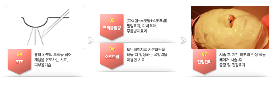 04.BTS-���� �Ϻ��� ������ ���� ����� �����ϴ� ġ��, �Ǻ������.
05.Ʈ�����ʸ�-(������+������+����ũ��)�ʸ�ȿ��, �̹�ȿ��, �ָ�����ȿ��
06.����Ʈ��-��׷������� ī��ũ���� �¿� �� �߻��ϴ� ���߷��� �̿��� ġ��
07.��������-�ü� �� ��ģ �Ǻ��� ���� �ۿ�, ������ �ü� �� �� �� ����ȿ��