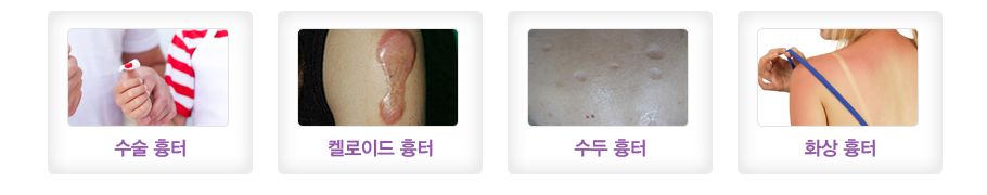 ���� ����,�̷��̵� ����,���� ����,ȭ�� ����