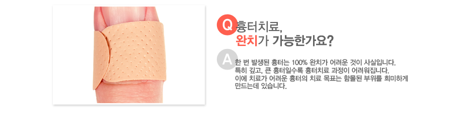 [����:����ġ��,��ġ�� �����Ѱ���?][�亯:�� �� �߻��� ���ʹ� 100% ��ġ�� ����� ���� ����Դϴ�. Ư�� ����, ū �����ϼ��� ����ġ�� ������ ��������ϴ�. �̿� ġ�ᰡ ����� ������ ġ�� ��ǥ�� �Ը��� ������ ����ϰ� ����µ� �ֽ��ϴ�.]