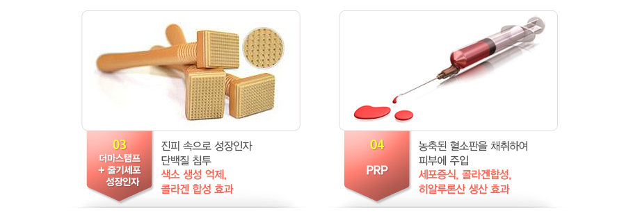 03.����������+�ٱ⼼�� ��������-���� ������ �������� �ܹ��� ħ�� ���� ���� ����, �ݶ�� �ռ� ȿ��
04.PRP-����� �������� ä���Ͽ� �Ǻο� ���� ��������, �ݶ���ռ�, ���˷�л� ���� ȿ��