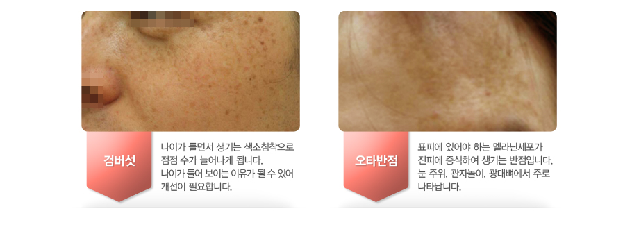 [�˹���]���̰� ��鼭 ����� ����ħ������ ���� ���� �þ�� �˴ϴ�. ���̰� ��� ���̴� ������ �� �� �־� ������ �ʿ��մϴ�.[��Ÿ����]ǥ�ǿ� �־�� �ϴ� ���Ѽ����� ���ǿ� �����Ͽ� ����� �����Դϴ�. �� ����, ���ڳ���, ��������� �ַ� ��Ÿ���ϴ�.