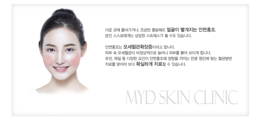 �߻�����