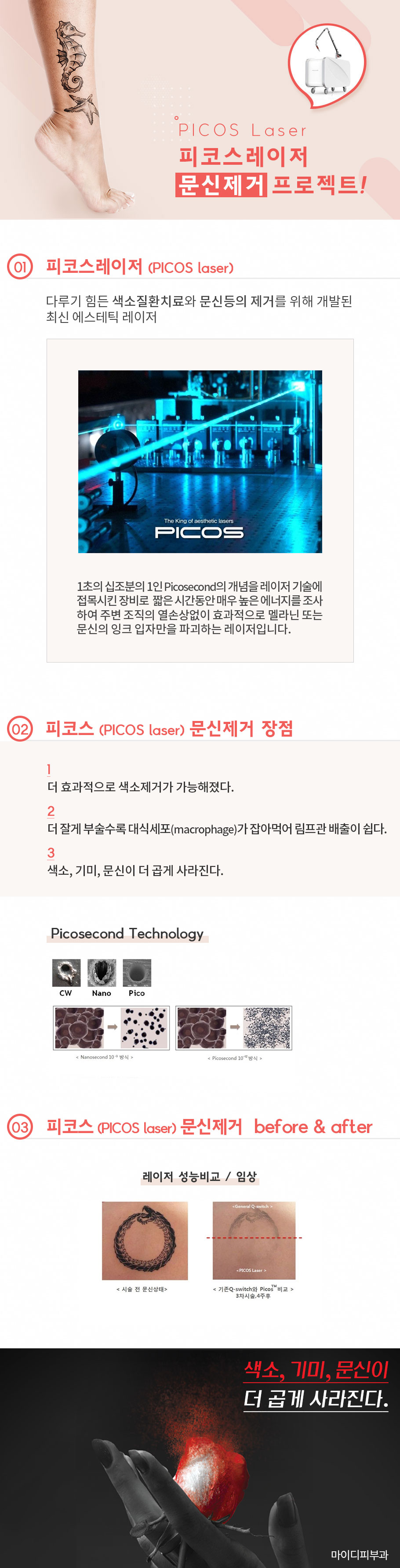 [��������(TŬ��)]���� �ɸ��� ��������? �Ϸ� �� �� TŬ��. Tatto clean & Triple & Total �Ϸ� �������� ���α׷�