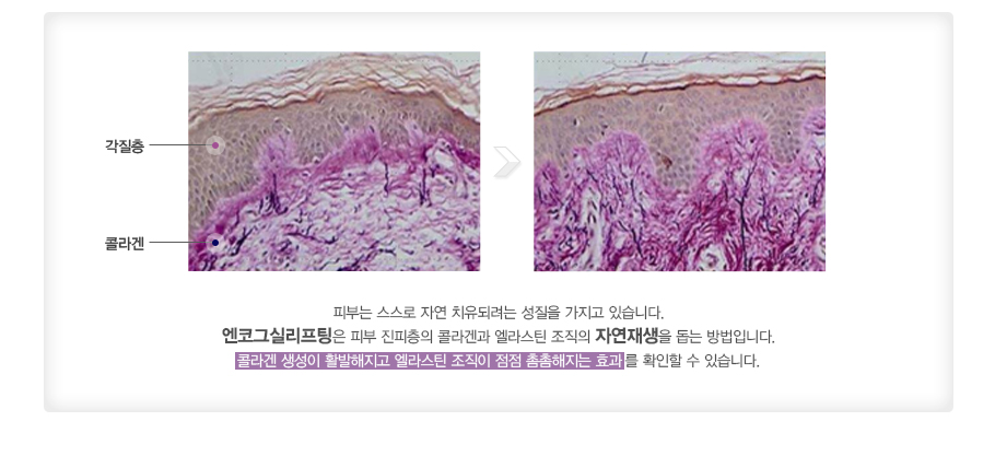 �Ǻδ� ������ �ڿ� ġ���Ƿ��� ������ ������ �ֽ��ϴ�.���ڱ׽Ǹ������� �Ǻ� �������� �ݶ�հ� ����ƾ ������ �ڿ������ ���� ����Դϴ�.�ݶ�� ������ Ȱ�������� ����ƾ ������ ���� ���������� ȿ���� Ȯ���� �� �ֽ��ϴ�.