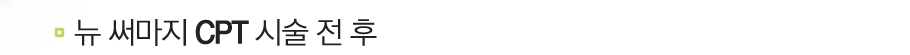 �� �Ḷ�� CPT �ü� �� ��