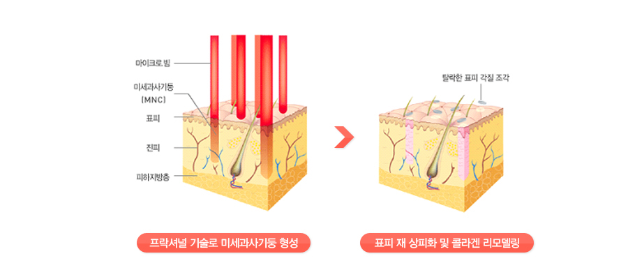 �����ų� ����� �̼������� ���� -> ǥ�� �� ����ȭ �� �ݶ�� ���𵨸�