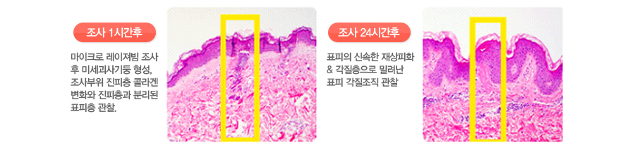 (���� 1�ð���)����ũ�� �������� ���� �� �̼�����������, ������� ������ �ݶ�� ��ȭ�� �������� �и��� ǥ���� ����.(���� 24�ð���)ǥ���� �ż��� �����ȭ & ���������� �з��� ǥ�� �������� ����