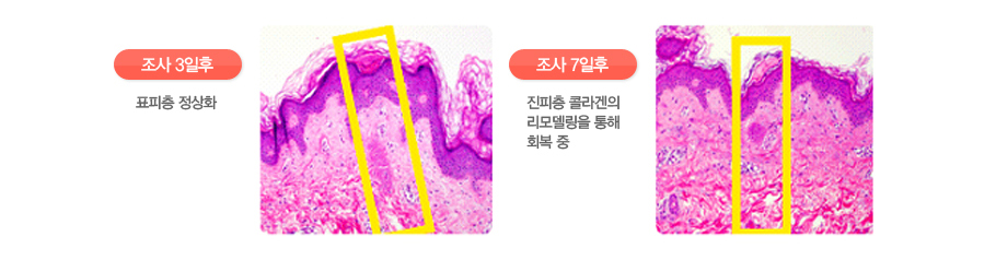 (���� 3����)ǥ���� ����ȭ(���� 7����)������ �ݶ���� ���𵨸��� ���� ȸ�� ��