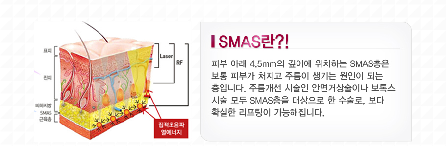 SMAS��?�Ǻ� �Ʒ� 4.5mm�� ���̿� �����ϴ� SMAS���� ���� �Ǻΰ� ó���� �ָ��� ����� ������ �Ǵ� ���Դϴ�.�ָ����� �ü��� �ȸ�Ż���̳� ���彺�ü� ��� SMAS���� ������� �� ������, ���� Ȯ���� �������� ���������ϴ�.