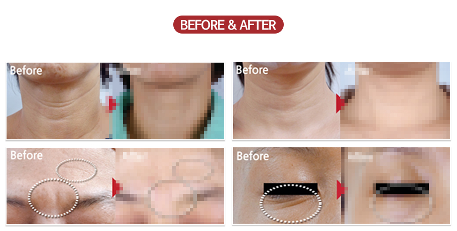 �ü����Ļ���