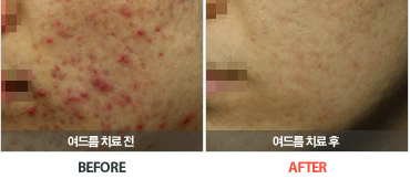 ���帧ġ�����Ļ���