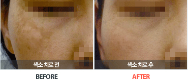 ���ġ�����Ļ���