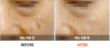 ����ġ�����Ļ���